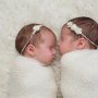 Emoție pură! Două gemene siameze s-au privit pentru prima dată în ochi după ce au trecut printr-o operație de 16 ore