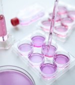 Recoltarea de celule stem: beneficii, proceduri si preturi