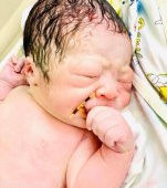 Bebelușul care s-a născut cu steriletul mamei sale în mână: fotografia unui adevărat supraviețuitor