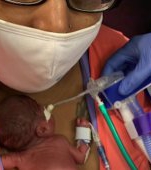A intrat în Cartea Recordurilor! Cum arată „cel mai prematur” bebeluș din lume care a supraviețuit