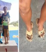 Nu și-a permis pantofi sport! O fetiță și-a bandajat picioarele pentru a participa la un concurs. A câștigat 3 medalii de aur