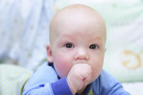 Dermatita seboreica la bebelusi - cauze, simptome si tratament