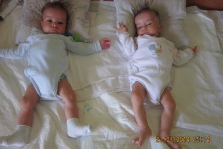 Robert si Bogdan, gemeni in varsta de 4 luni, au nevoie de ajutor!