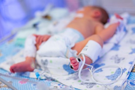 Premiera in sistemul medical privat, la Spitalul Baneasa: gemeni nascuti la doar 24 de saptamani, supravietuiesc si au o evolutie favorabila