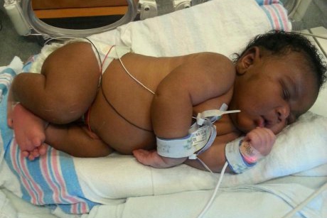  Surpriza de proportii pentru o proaspata mamica: bebelusul a cantarit peste 6 kilograme la nastere