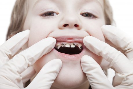 Probleme in dentitia copilului: ghid pe varste 