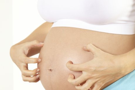 Prevenirea si reducerea vergeturilor in sarcina