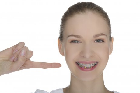 6 mituri despre aparatele dentare