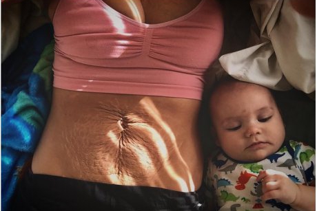 Partea întunecată a sarcinii: poza virală a unei mame ce demonstrează mult curaj