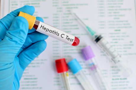 Tot ce trebuie să știi despre hepatita C