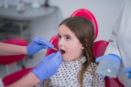 Sigilarea dentară: cât este de utilă 