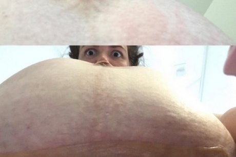 Așa arată burtica după cezariană! Fotografia sinceră a unei mame care a isterizat internetul