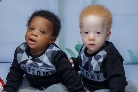 A născut doi copii complet diferiți, dar sunt gemeni identici! Cum este posibil?