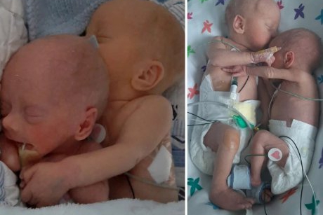 Imaginea care a înduioșat internetul. Doi bebeluși gemeni născuți prematur se îmbrățișează când sunt puși în același incubator