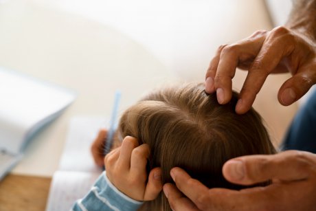 O fetiță de 8 ani cu alopecie este dovada clară de curaj! Și-a pierdut părul, dar și-a păstrat încrederea în ea