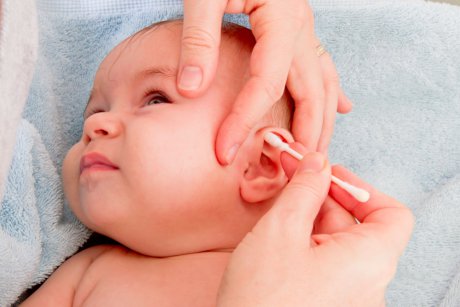 Curatarea corecta a urechilor la bebelusi (P)