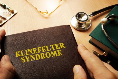Sindromul Klinefelter: informații complete