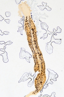 viermisori intestinali viermisori intestinali
