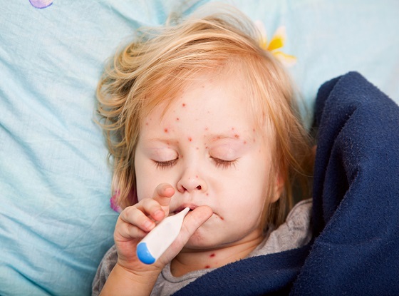 fetita blonda cu o boala contagioasa care nu se simte bine din cauza febrei si sta in pat