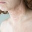 Dermatita exfoliativă: cauze, simptome și tratament