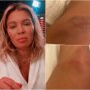 Gina Pistol și-a pus sarcina în pericol: „Am căzut rău! Mă doare de mor!”