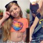 Fetiţa care trăieşte cu inima în afara pieptului a împlinit 11 ani și duce o viață normală! Medicii nu i-au dat nicio șansă