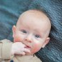 Ghid pentru părinți: legătura dintre dermatita atopică și sănătatea digestivă a bebelușilor