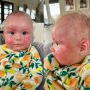 Realitatea crizei de lapte praf: o mamă publică poze cu bebelușul ei alergic