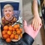 Un copil a ajuns de urgență la spital, cu pielea galbenă, după ce a mâncat prea multe portocale. Ce diagnostic a primit