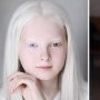 Are 11 ani, suferă de albinism și este una dintre cele mai frumoase fetițe din lume!