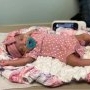 Premieră medicală! Prima operație pe creier reușită la un bebeluș aflat încă în pântecul mamei