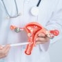 Legarea trompelor uterine: beneficii și complicații