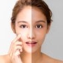 Asimetria facială: ce este și cum o poți rezolva