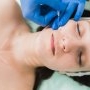 Lifting cu fire bioresorbabile: recomandări și recuperare