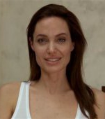 Angelina Jolie a facut varicela!