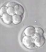 Dupa tratamentele de fertilizare, sotia mea a ramas insarcinata cu tripleti, dar a vrut sa avorteze doi dintre ei