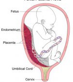 Placenta Praevia - cauze, complicatii si tratament