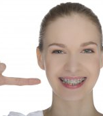 6 mituri despre aparatele dentare