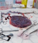 Placenta: un organ de importanță vitală