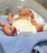 Doar 8 cazuri in lume: bebeluşul născut fără faţă la maternitatea din Botoşani