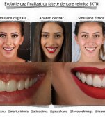 Estetică dentară în timp real, inovație stomatologică la Neoclinique