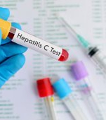 Tot ce trebuie să știi despre hepatita C