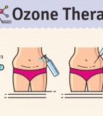 Ce este ozonoterapia? 