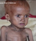 Holeră și foamete în Yemen! Copiii mor pe capete, mamele plâng!
