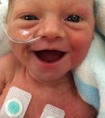 De ce această fotografie cu un bebeluș prematur a primit milioane de like-uri