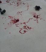 O mamă dezvăluie poze cu băiatul ei plin de sânge după ce a fost brutalizat de colegii de la școală