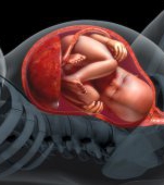 Placenta accreta: cauze și simptome