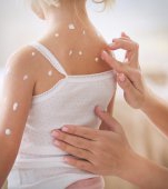 5 boli și afecțiuni care-i pot strica vara copilului tău