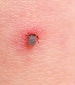 Alertă medicală: a început sezonul căpușelor! Există deja un prim caz!