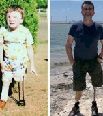 Cum arată acum bebelușul respins de părinți pentru că era prea urât